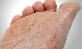 Lábgomba átviteli útvonalak