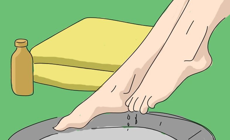 Almaecetes fürdő lábgomba ellen